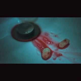 Brett (Bananas) Clarke