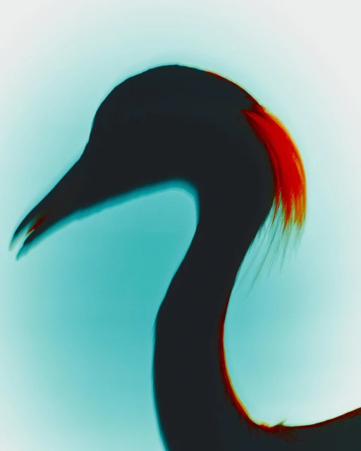 Walter Schupfer Management