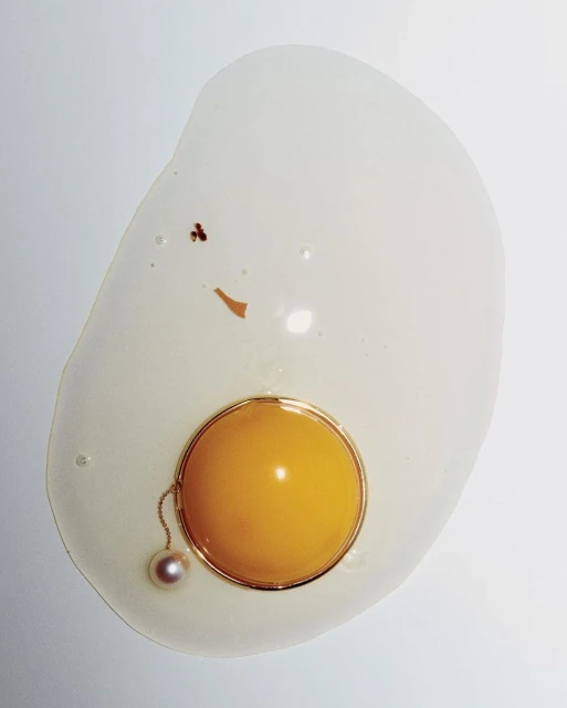 Walter Schupfer Management