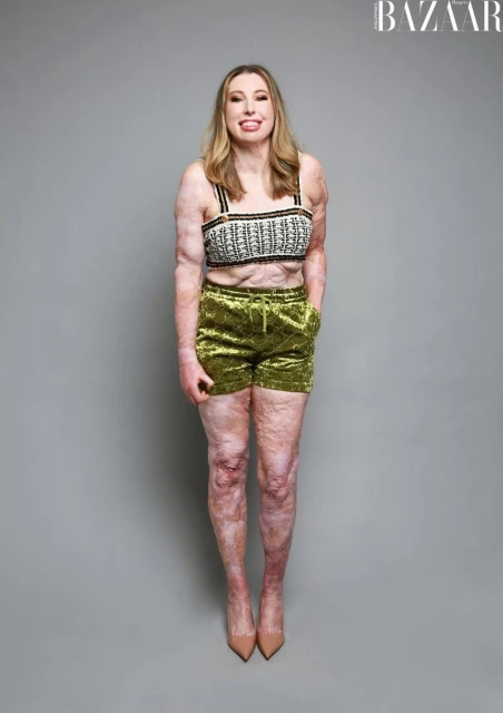 Improving representation and Inclusion in fashion