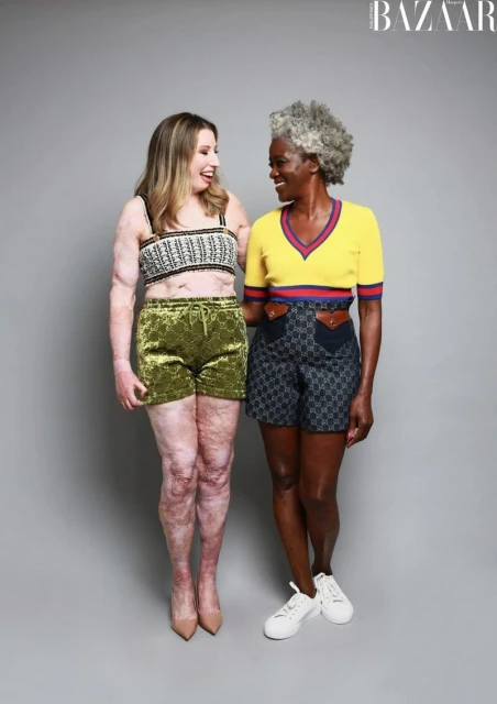 Improving representation and Inclusion in fashion